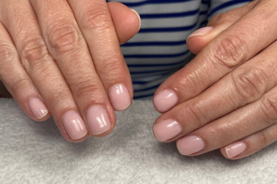 NH Ongles - photo 3